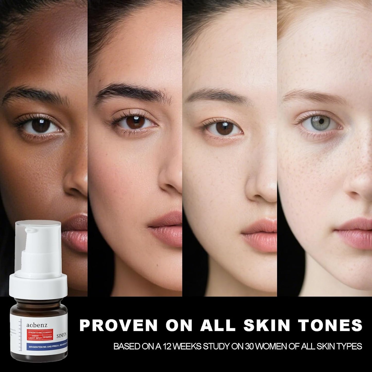 Aobenz Dark Spot Remover for Face & Body | Advanced Corrector Serum for Age, Melasma, Sun, Acne, Black Spots | Tranexamic Acid, Niacinamide Formula for Women & Men | Mild, 1.35 Fl Oz (1PCS)