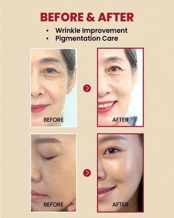 Unveil Radiant, Youthful Skin Today!